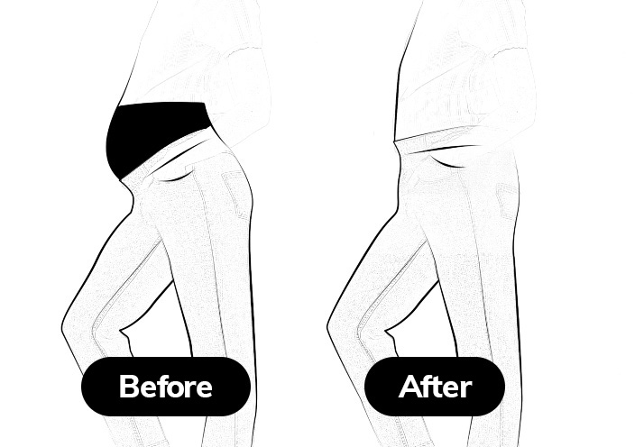 Before After